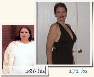 Gina Roux-en-Y Gastric Bypass