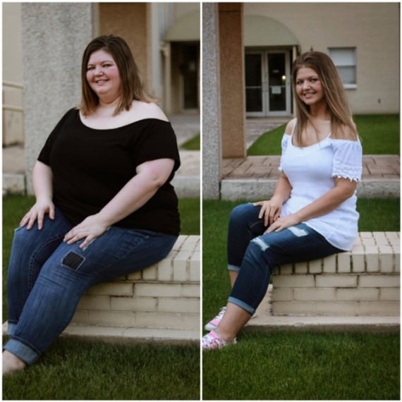 Brandolyn - before and after bariatric surgery