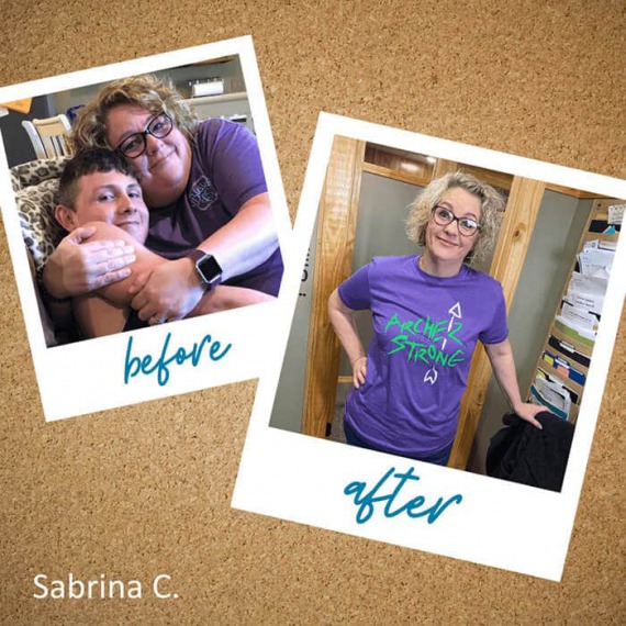 Sabrina - Before and after bariatric surgery