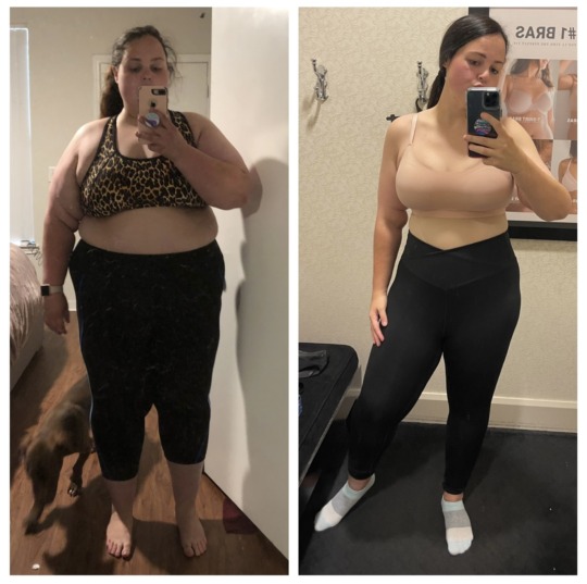 Weight Loss Surgery in Indiana | JourneyLite - Weight Loss Surgery ...