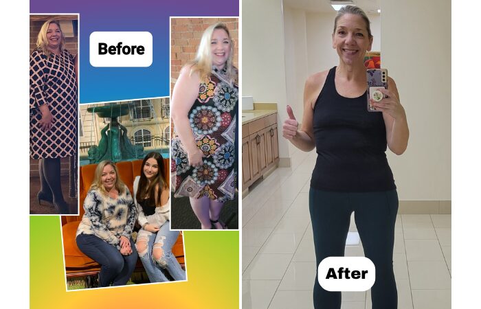 Christine Let Go of Fear and Embraced Her New Life - Weight Loss Surgeon